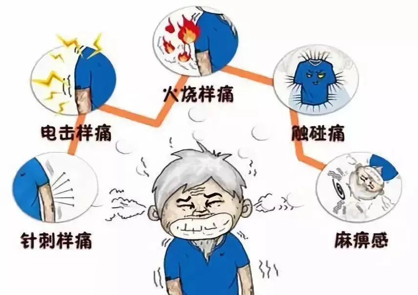 挑战“天下第一痛”我院完成三叉神经微血管减压术